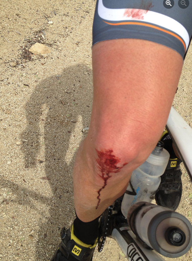 THE SCARS TO PROVE IT