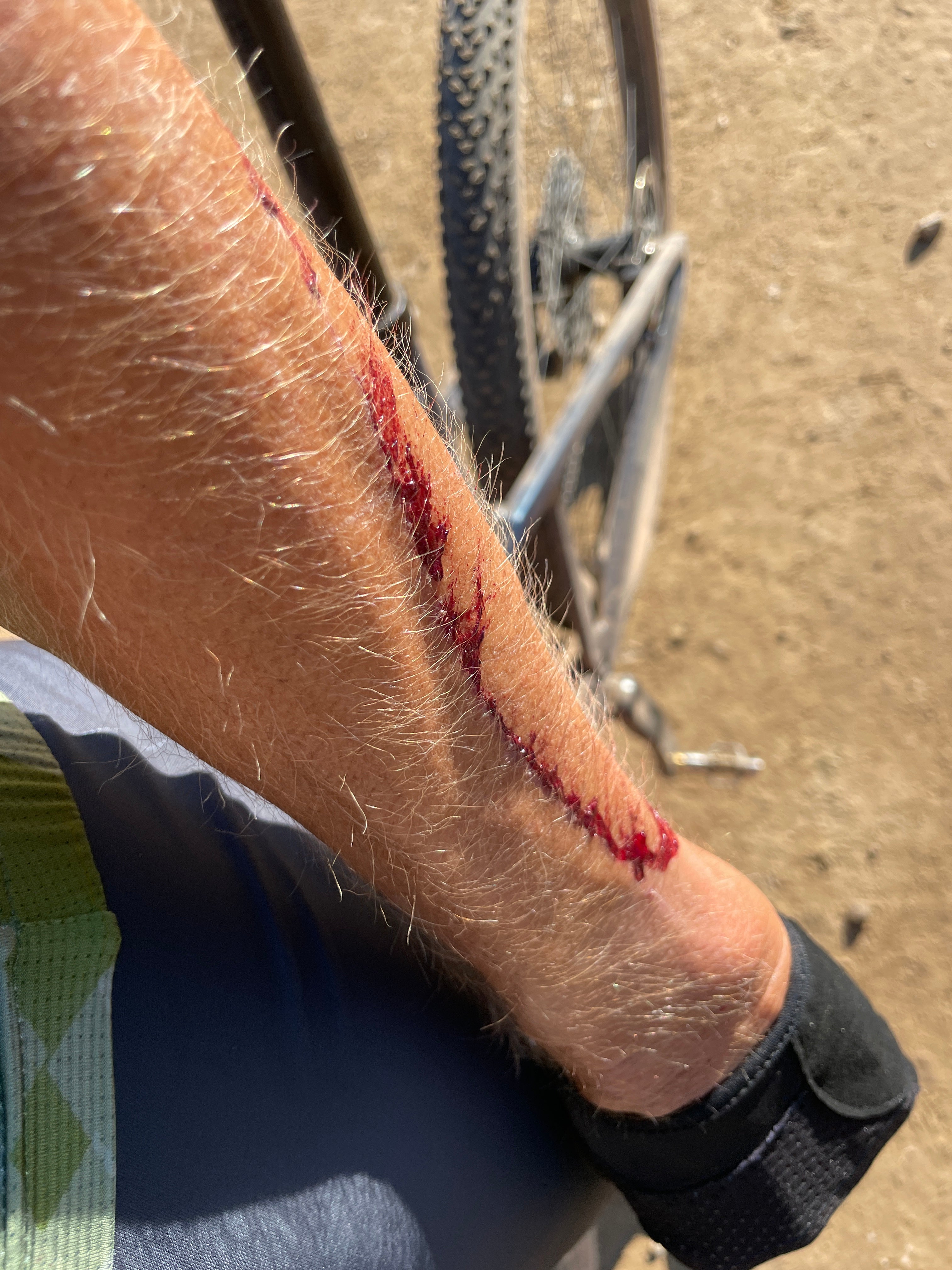 TOO EARLY FOR THE SUN