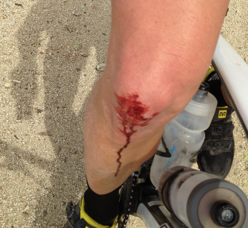 WHAT HEALS THE FASTEST?