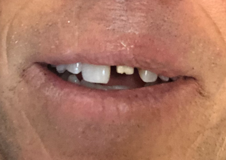 THE WHEELIE THAT KEEPS ON GIVING