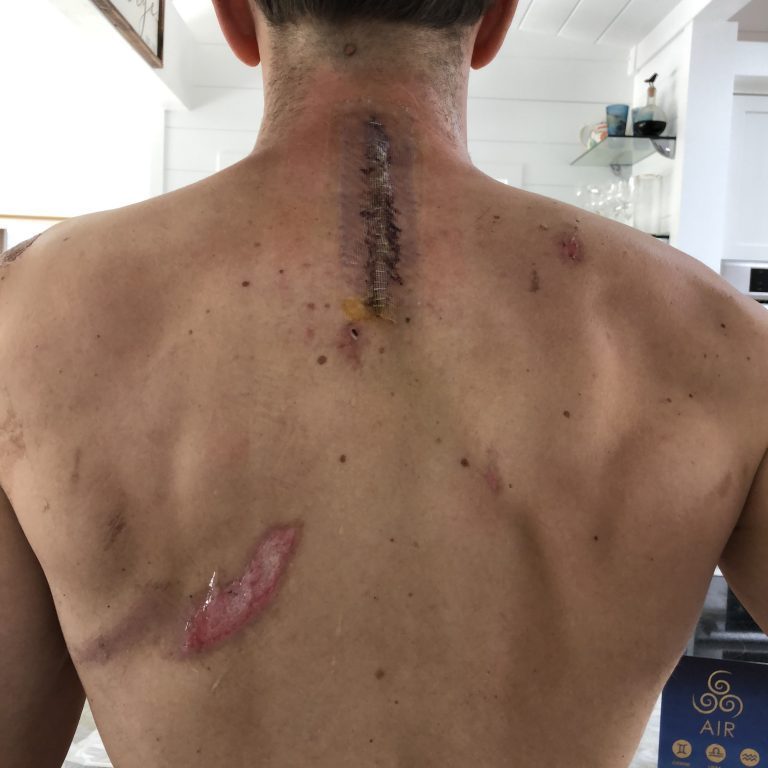 STRAVA CUTE. ANALOG REAL.