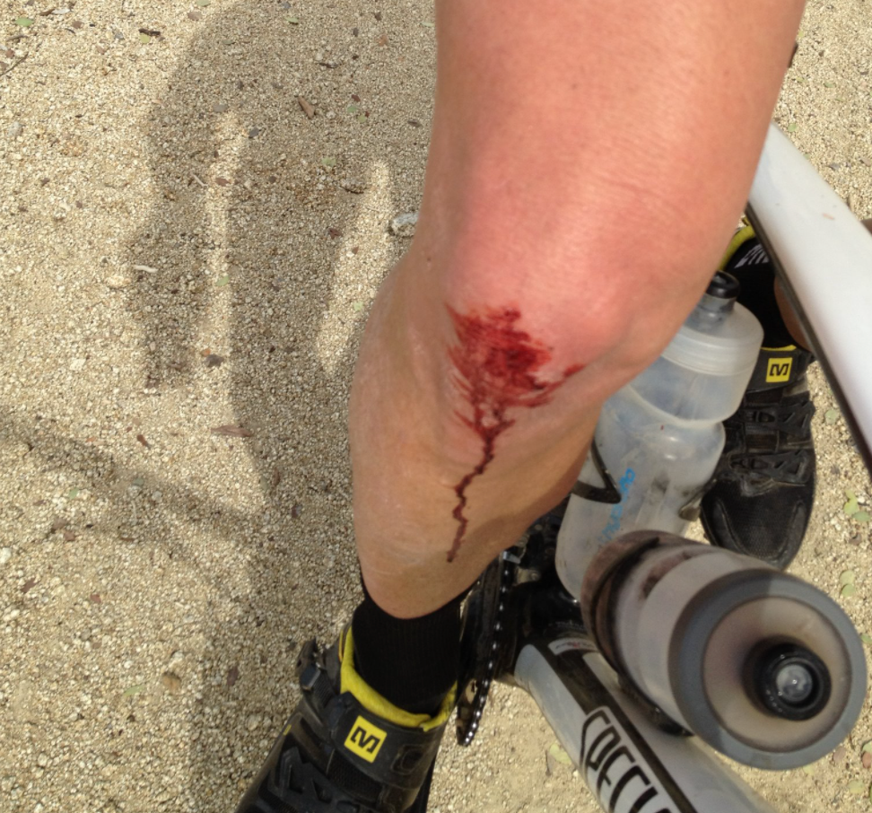 I'M THANKFUL FOR SCARS