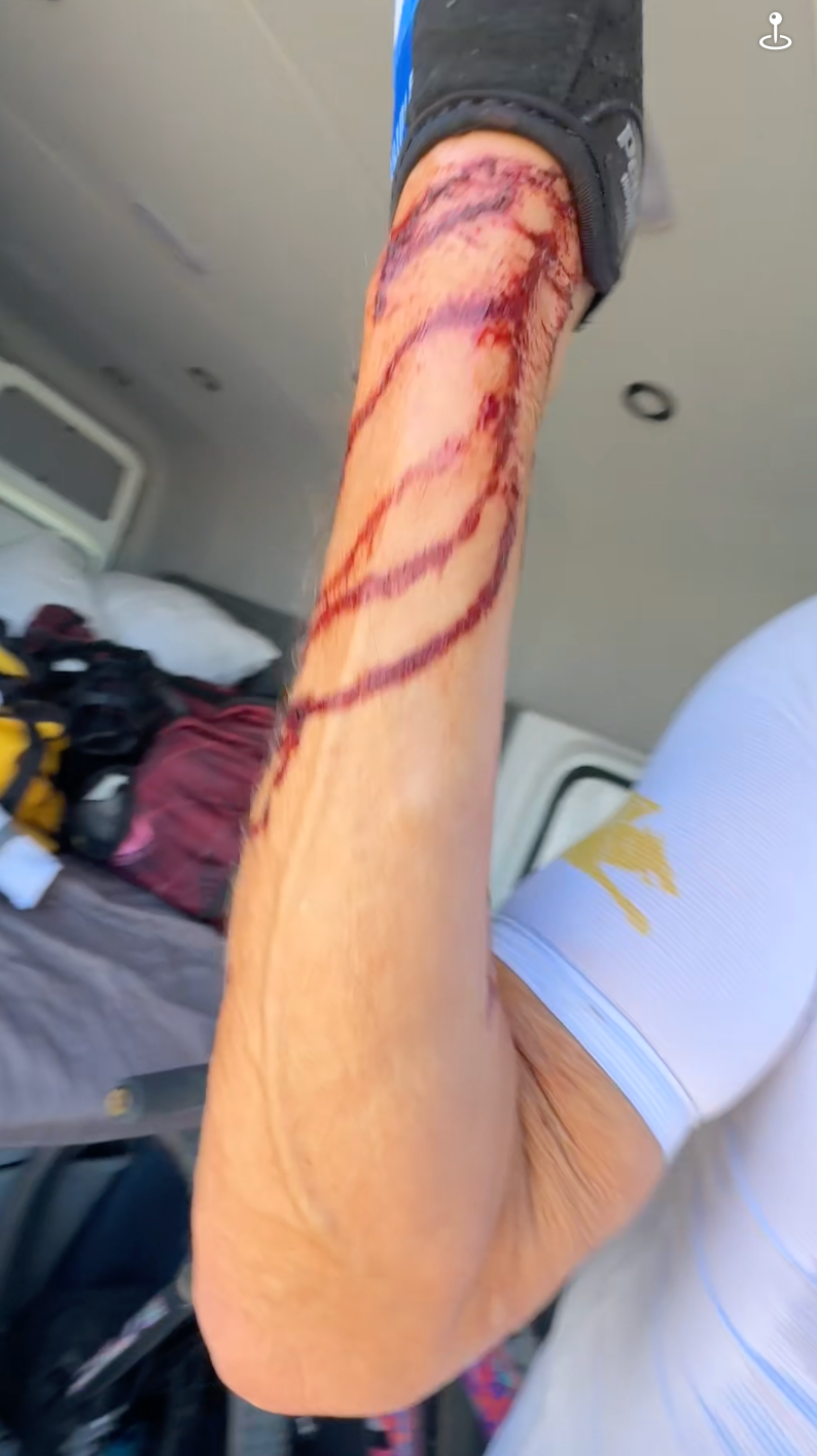 IF YA AIN'T BLEEDIN' YA AIN'T TRYIN'... REALLY?