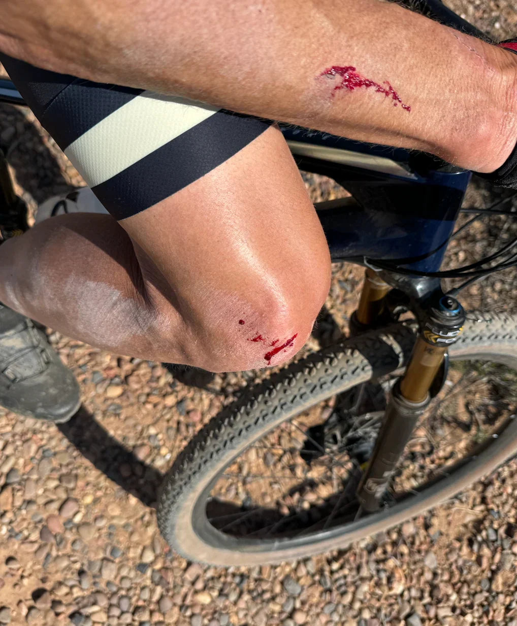 DON'T HIT THE ROCK!, IS TERRIBLE ADVICE